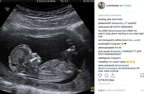 Justin Bieber bị chỉ trích vì lấy chuyện vợ mang thai ra để làm trò đùa vào ngày Cá tháng Tư Justin Bieber bị chỉ trích vì lấy chuyện vợ mang thai ra để làm trò đùa vào ngày Cá tháng Tư