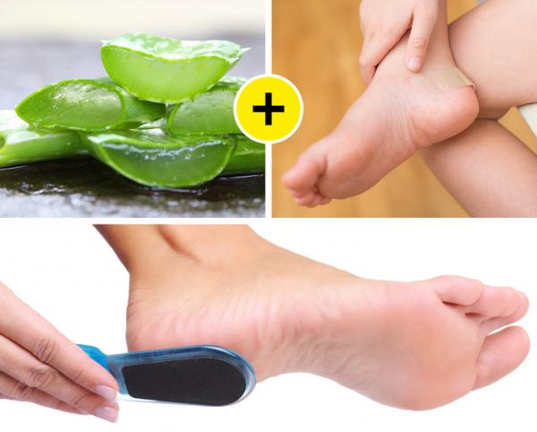 10 tips sau đây sẽ giúp bạn nhanh chóng 'tạm biệt' làn da chai sạn 10 tips sau đây sẽ giúp bạn nhanh chóng 'tạm biệt' làn da chai sạn