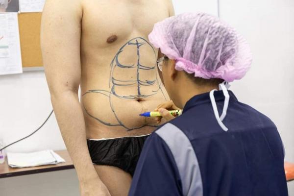 Khỏi cần tập gym vẫn có thể sở hữu body sáu múi chuẩn manly nhờ... dao kéo Khỏi cần tập gym vẫn có thể sở hữu body sáu múi chuẩn manly nhờ... dao kéo