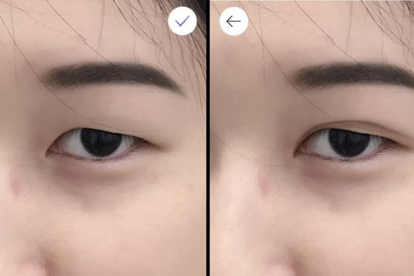 Lịch sử đen tối đằng sau phương pháp làm đẹp cắt mắt hai mí mà nhiều phụ nữ châu Á yêu thích Lịch sử đen tối đằng sau phương pháp làm đẹp cắt mắt hai mí mà nhiều phụ nữ châu Á yêu thích