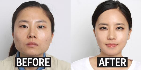 Lịch sử đen tối đằng sau phương pháp làm đẹp cắt mắt hai mí mà nhiều phụ nữ châu Á yêu thích Lịch sử đen tối đằng sau phương pháp làm đẹp cắt mắt hai mí mà nhiều phụ nữ châu Á yêu thích