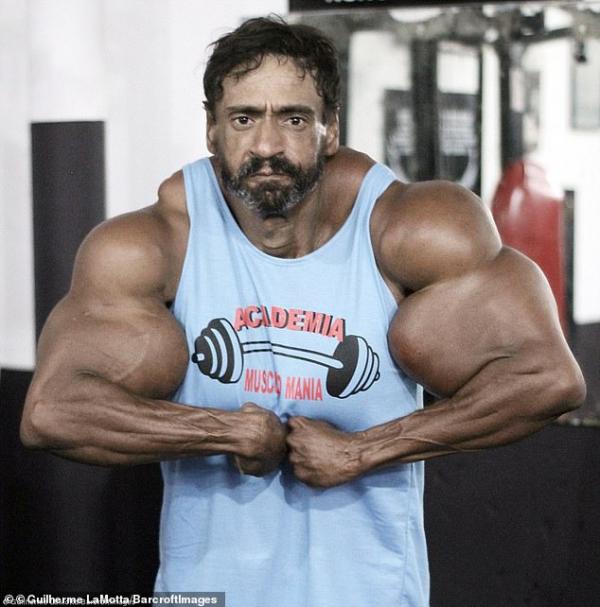 Ông chú Brazil liều mạng tiêm synthol để có cơ bắp 'khủng' như Hulk Ông chú Brazil liều mạng tiêm synthol để có cơ bắp 'khủng' như Hulk