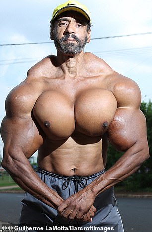 Ông chú Brazil liều mạng tiêm synthol để có cơ bắp 'khủng' như Hulk Ông chú Brazil liều mạng tiêm synthol để có cơ bắp 'khủng' như Hulk