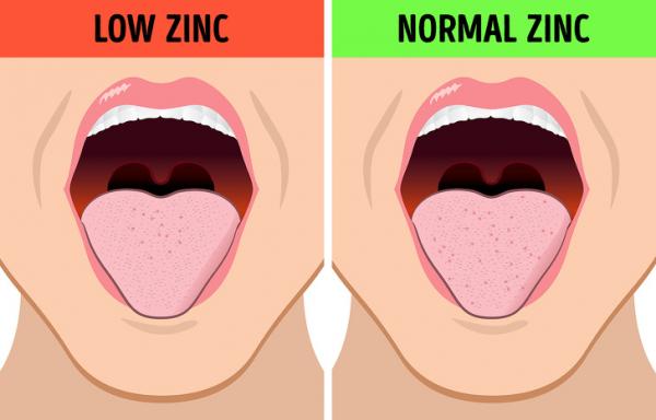 Cảm thấy mùi vị lạ trong miệng có thể là dấu hiệu về tình trạng sức khoẻ không tốt Cảm thấy mùi vị lạ trong miệng có thể là dấu hiệu về tình trạng sức khoẻ không tốt