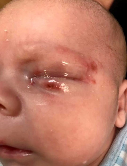Yêu trẻ con không cẩn trọng, những người lớn vô tâm đã suýt khiến một em bé bị mù mắt Yêu trẻ con không cẩn trọng, những người lớn vô tâm đã suýt khiến một em bé bị mù mắt