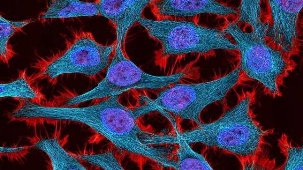 Henrietta Lacks: Cái chết để cứu sống hàng triệu người và tấn bi kịch đằng sau Henrietta Lacks: Cái chết để cứu sống hàng triệu người và tấn bi kịch đằng sau