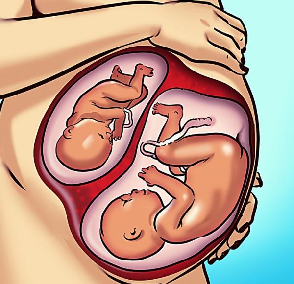 Có thể nào trong quá trình mang thai vẫn có thể xuất hiện thêm một bào thai nữa? Có thể nào trong quá trình mang thai vẫn có thể xuất hiện thêm một bào thai nữa?
