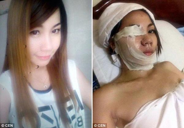 Cô gái định tạt axit bạn trai cũ nhưng bị 'nghiệp quật' khi chính mình cũng bỏng nặng Cô gái định tạt axit bạn trai cũ nhưng bị 'nghiệp quật' khi chính mình cũng bỏng nặng