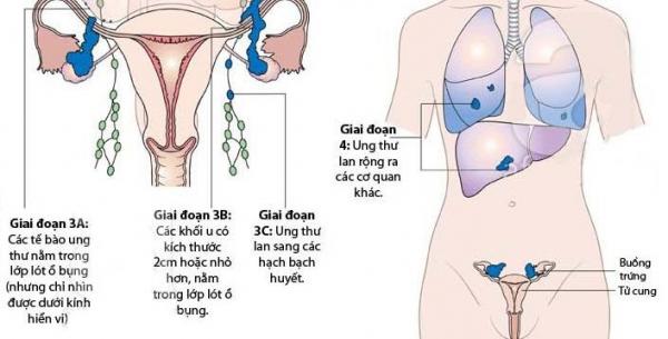 Trớ trêu: Những căn bệnh ung thư nguy hiểm nhất lại nhận được ít vốn tài trợ nghiên cứu nhất Trớ trêu: Những căn bệnh ung thư nguy hiểm nhất lại nhận được ít vốn tài trợ nghiên cứu nhất