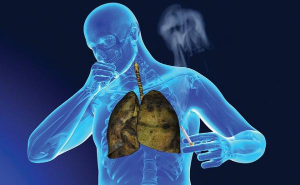 Trớ trêu: Những căn bệnh ung thư nguy hiểm nhất lại nhận được ít vốn tài trợ nghiên cứu nhất Trớ trêu: Những căn bệnh ung thư nguy hiểm nhất lại nhận được ít vốn tài trợ nghiên cứu nhất