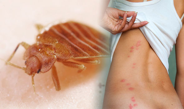 Nhìn vết cắn, 'điểm mặt chỉ tên' ngay loại côn trùng vừa cắn mình Nhìn vết cắn, 'điểm mặt chỉ tên' ngay loại côn trùng vừa cắn mình