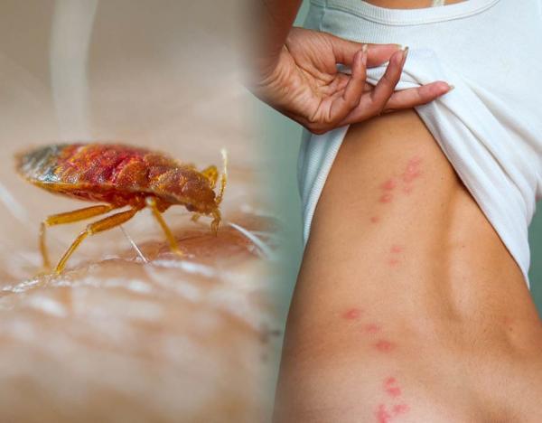 Bạn sẽ thốt lên 'Ghê quá' khi biết những loài sinh vật này đang 'xây nhà' trên cơ thể mình Bạn sẽ thốt lên 'Ghê quá' khi biết những loài sinh vật này đang 'xây nhà' trên cơ thể mình