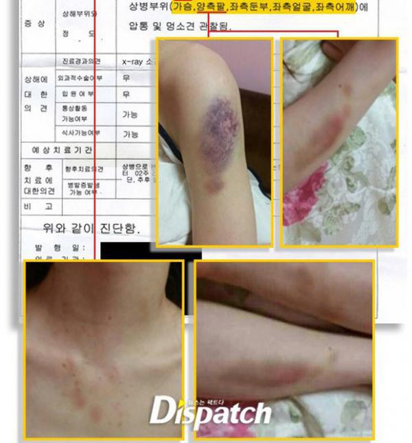 7 bê bối khủng khiếp khiến người ta tưởng showbiz Hàn đã đến 'ngày tàn' 7 bê bối khủng khiếp khiến người ta tưởng showbiz Hàn đã đến 'ngày tàn'
