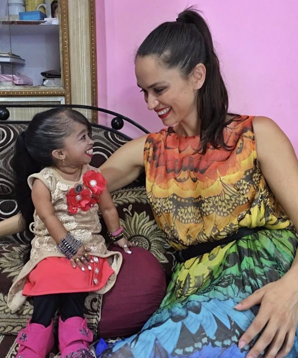 Dị nhân phiên bản đời thực phá vỡ mọi quy luật bình thường: Mũi siêu to, mắt như mèo, đầu bẻ cong đinh... Dị nhân phiên bản đời thực phá vỡ mọi quy luật bình thường: Mũi siêu to, mắt như mèo, đầu bẻ cong đinh...