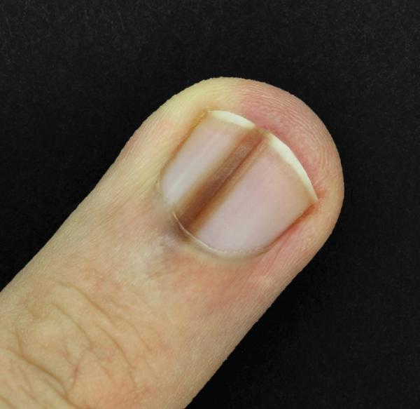 10 thay đổi nhỏ nhưng tiết lộ tình trạng 'báo động đỏ' về sức khỏe của bạn 10 thay đổi nhỏ nhưng tiết lộ tình trạng 'báo động đỏ' về sức khỏe của bạn