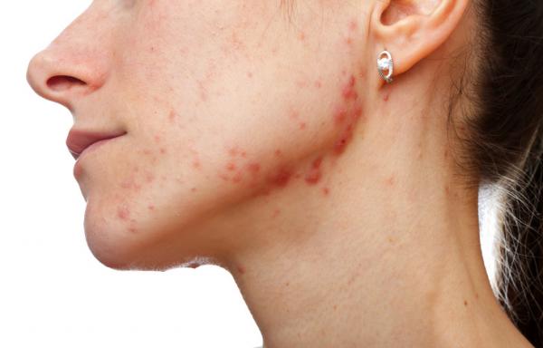 10 thay đổi nhỏ nhưng tiết lộ tình trạng 'báo động đỏ' về sức khỏe của bạn 10 thay đổi nhỏ nhưng tiết lộ tình trạng 'báo động đỏ' về sức khỏe của bạn