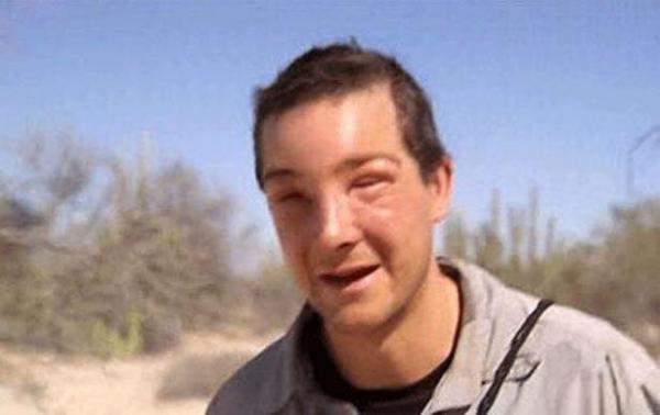 Bear Grylls bị ong đốt khiến tính mạng 'ngàn cân treo sợi tóc' trên đảo Thái Bình Dương Bear Grylls bị ong đốt khiến tính mạng 'ngàn cân treo sợi tóc' trên đảo Thái Bình Dương