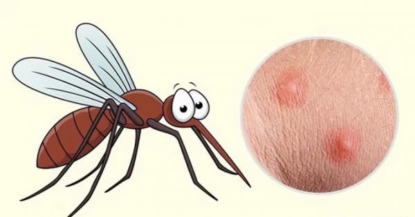 Vì sao có người liên tục bị muỗi cắn, còn những người khác thì muỗi chẳng đoái hoài? Vì sao có người liên tục bị muỗi cắn, còn những người khác thì muỗi chẳng đoái hoài?
