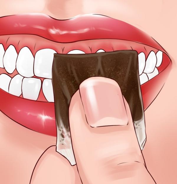 Nếu bạn thường xuyên bị chảy máu nướu, hãy thử áp dụng ngay 10 tip đơn giản này Nếu bạn thường xuyên bị chảy máu nướu, hãy thử áp dụng ngay 10 tip đơn giản này