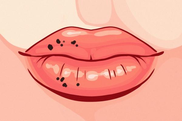 Đừng chủ quan, hãy nhớ những dấu hiệu của đôi môi cho thấy sức khỏe đang 'kêu cứu' bạn Đừng chủ quan, hãy nhớ những dấu hiệu của đôi môi cho thấy sức khỏe đang 'kêu cứu' bạn