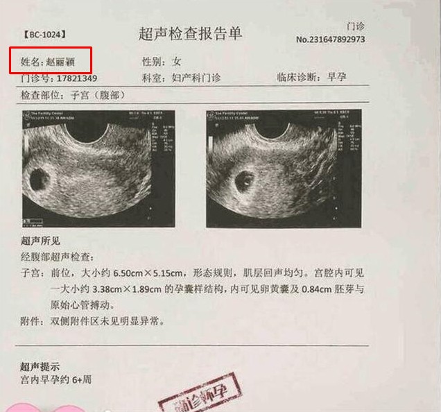Triệu Lệ Dĩnh bí mật sắm đồ em bé, giới tính con đầu lòng vẫn còn là ẩn số Triệu Lệ Dĩnh bí mật sắm đồ em bé, giới tính con đầu lòng vẫn còn là ẩn số