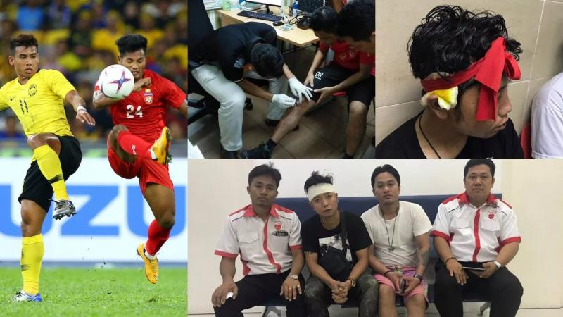 Chung kết AFF Cup 2018: 'Bóng ma' bạo lực sân cỏ ám ảnh Việt Nam trên sân Bukit Jalil Chung kết AFF Cup 2018: 'Bóng ma' bạo lực sân cỏ ám ảnh Việt Nam trên sân Bukit Jalil